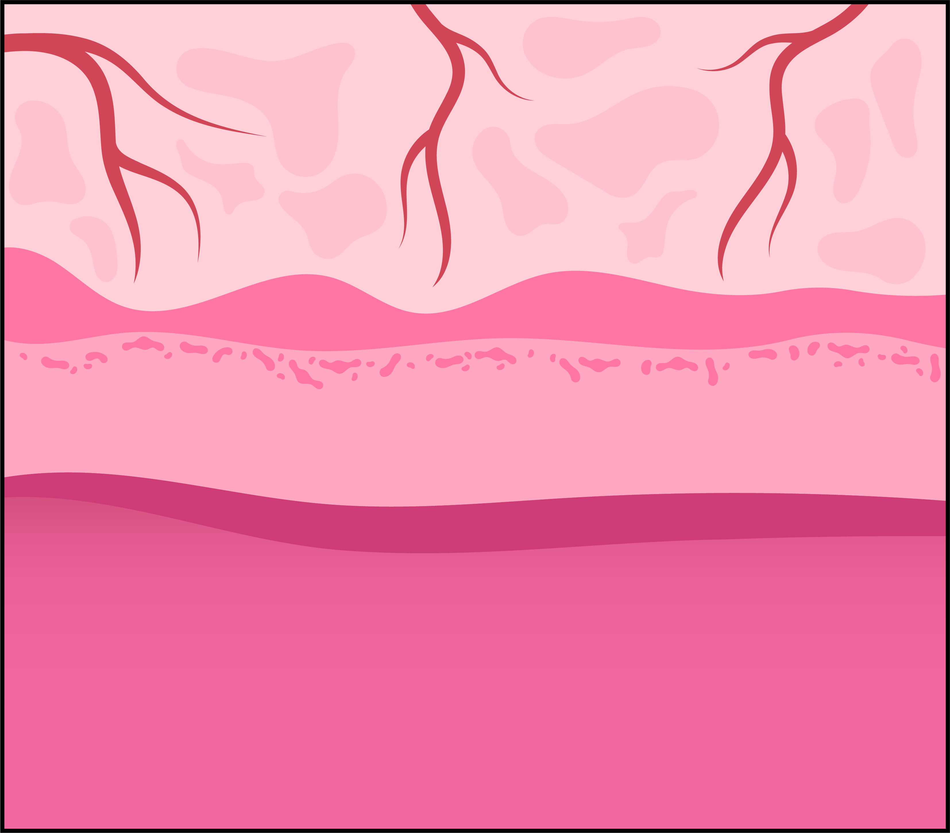 Vaihdevuosi-ikäisen naisen ohentunut limakalvo